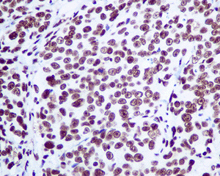 Immunohistochemistry (Formalin/PFA-fixed paraffin-embedded sections) - Anti-Matrin 3 antibody [EPR10635(B)] (ab151714), expandable thumbnail