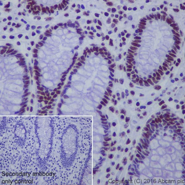 Immunohistochemistry (Formalin/PFA-fixed paraffin-embedded sections) - Anti-Matrin 3 antibody [EPR10635(B)] (AB151714), expandable thumbnail