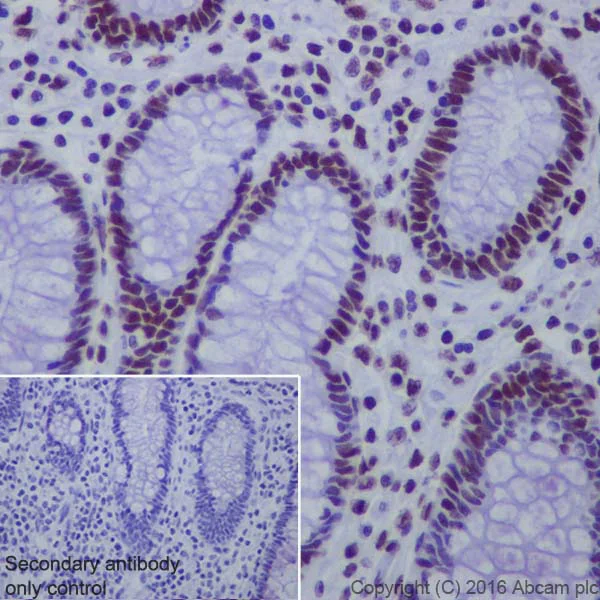 Immunohistochemistry (Formalin/PFA-fixed paraffin-embedded sections) - Anti-Matrin 3 antibody [EPR10635(B)] (AB151714)