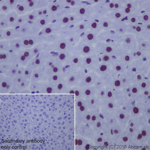 Immunohistochemistry (Formalin/PFA-fixed paraffin-embedded sections) - Anti-Matrin 3 antibody [EPR10635(B)] (ab151714), expandable thumbnail