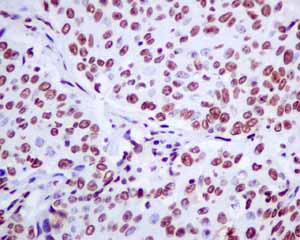 Immunohistochemistry (Formalin/PFA-fixed paraffin-embedded sections) - Anti-Matrin 3 antibody [EPR10635(B)] (ab151714), expandable thumbnail