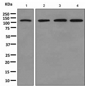 Western blot - Anti-Matrin 3 antibody [EPR10635(B)] (AB151714), expandable thumbnail