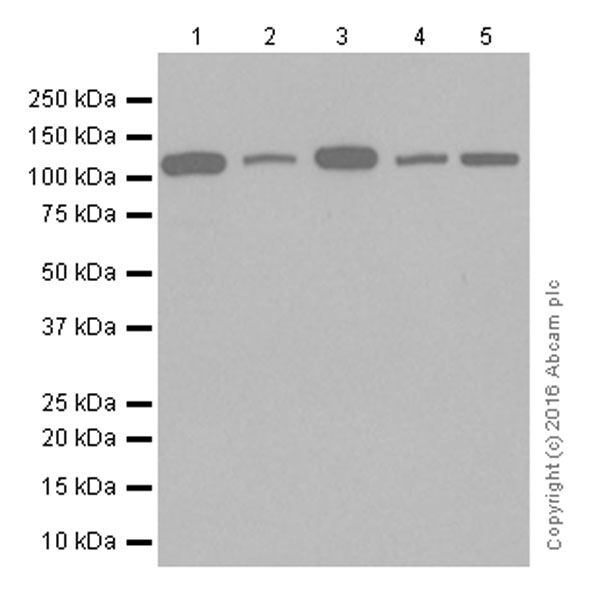 Western blot - Anti-Matrin 3 antibody [EPR10635(B)] (AB151714), expandable thumbnail