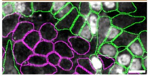 Immunocytochemistry/ Immunofluorescence - Anti-Matrin 3 antibody [EPR10635(B)] - BSA and Azide free (AB240123)