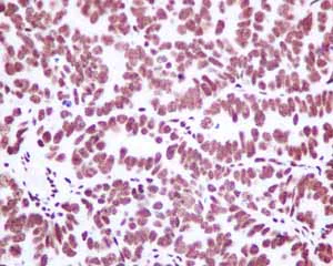 Immunohistochemistry (Formalin/PFA-fixed paraffin-embedded sections) - Anti-Matrin 3 antibody [EPR10635(B)] - BSA and Azide free (AB240123)