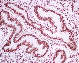 Immunohistochemistry (Formalin/PFA-fixed paraffin-embedded sections) - Anti-Matrin 3 antibody [EPR10635(B)] - BSA and Azide free (AB240123)