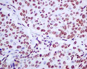 Immunohistochemistry (Formalin/PFA-fixed paraffin-embedded sections) - Anti-Matrin 3 antibody [EPR10635(B)] - BSA and Azide free (AB240123)