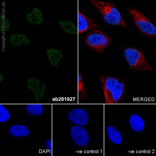 Immunocytochemistry/ Immunofluorescence - Anti-Matrin 3 antibody [Z-MATR3-4] - Mouse IgG2a (Chimeric) (AB281927)