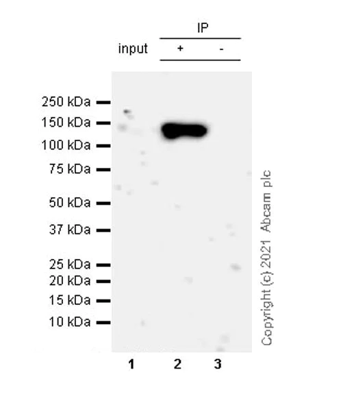 Immunoprecipitation - Anti-Matrin 3 antibody [Z-MATR3-4] - Mouse IgG2a (Chimeric) - BSA and Azide free (AB281947)