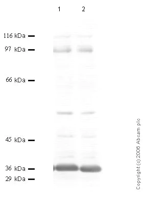Western blot - Anti-Matriptase 2 antibody - Catalytic domain (AB56182)