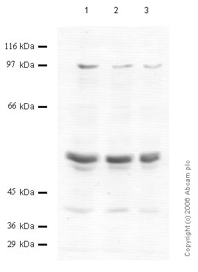 Western blot - Anti-Matriptase 2 antibody - Cytoplasmic domain (AB56180)