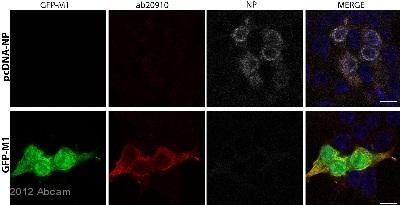 Immunocytochemistry/ Immunofluorescence - Anti-Matrix protein 1 antibody (AB20910)
