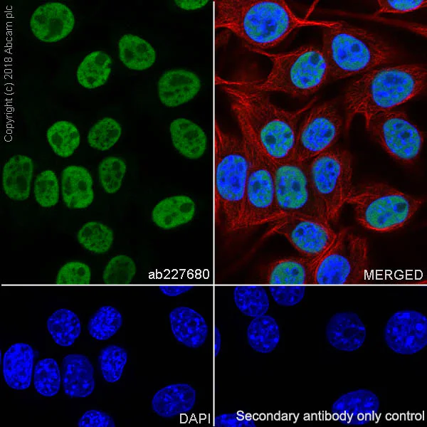 Immunocytochemistry/ Immunofluorescence - Mature Oligodendrocyte Marker (Olig2, MBP, MOG, SOX10) Antibody Sampler Panel - Human, Mouse (AB254026)