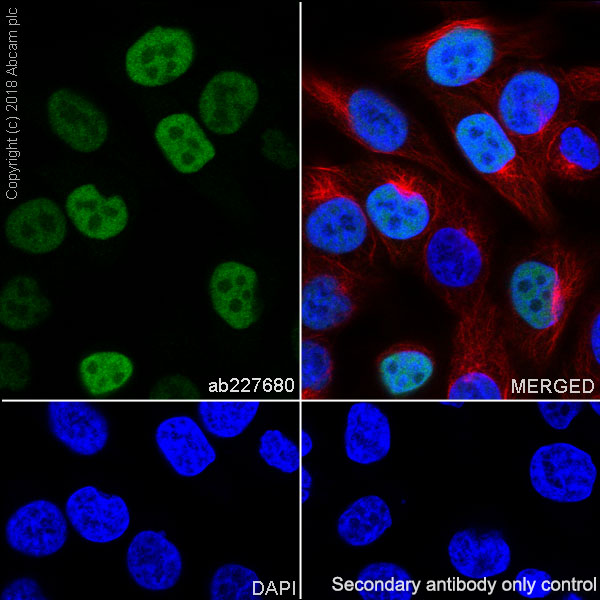 Immunocytochemistry/ Immunofluorescence - Mature Oligodendrocyte Marker (Olig2, MBP, MOG, SOX10) Antibody Sampler Panel - Human, Mouse (ab254026), expandable thumbnail