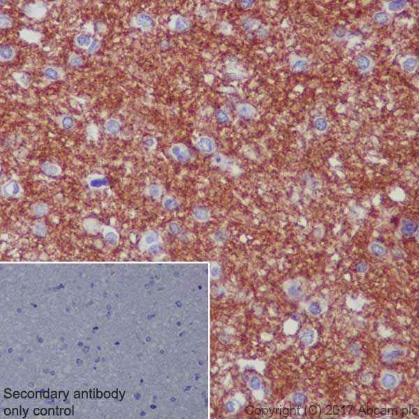 Immunohistochemistry (Formalin/PFA-fixed paraffin-embedded sections) - Mature Oligodendrocyte Marker (Olig2, MBP, MOG, SOX10) Antibody Sampler Panel - Human, Mouse (AB254026), expandable thumbnail
