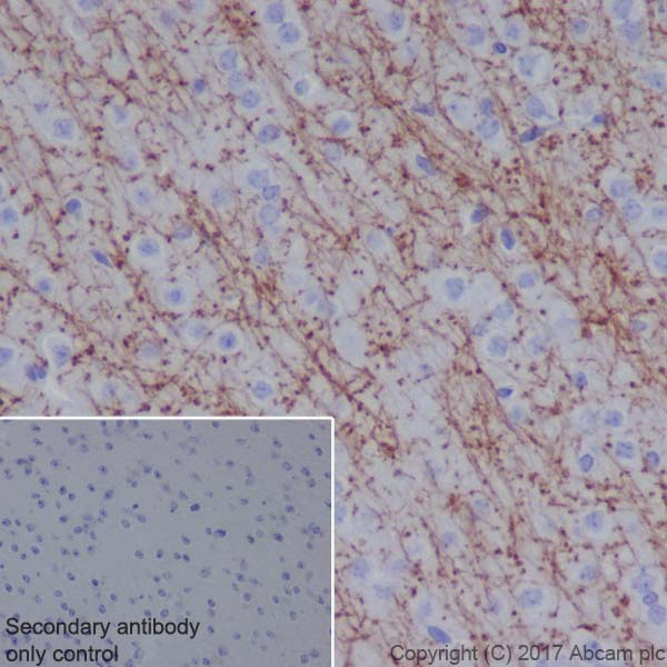 Immunohistochemistry (Formalin/PFA-fixed paraffin-embedded sections) - Mature Oligodendrocyte Marker (Olig2, MBP, MOG, SOX10) Antibody Sampler Panel - Human, Mouse (AB254026), expandable thumbnail