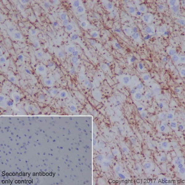 Immunohistochemistry (Formalin/PFA-fixed paraffin-embedded sections) - Mature Oligodendrocyte Marker (Olig2, MBP, MOG, SOX10) Antibody Sampler Panel - Human, Mouse (AB254026)