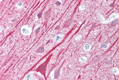 Immunohistochemistry (Formalin/PFA-fixed paraffin-embedded sections) - Anti-MAVS antibody (AB189109), expandable thumbnail