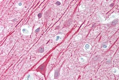 Immunohistochemistry (Formalin/PFA-fixed paraffin-embedded sections) - Anti-MAVS antibody (AB189109)