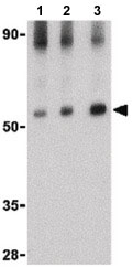 Western blot - Anti-MAVS antibody (AB189109), expandable thumbnail