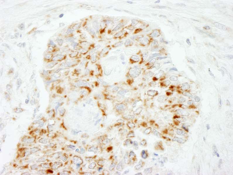 Immunohistochemistry (Formalin/PFA-fixed paraffin-embedded sections) - Anti-MAVS antibody (AB264147), expandable thumbnail