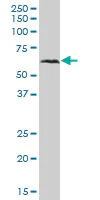 Western blot - Anti-MAVS antibody (AB89825)