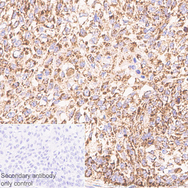 Immunohistochemistry (Formalin/PFA-fixed paraffin-embedded sections) - Anti-MAVS antibody [EPR26357-91] (AB290729)