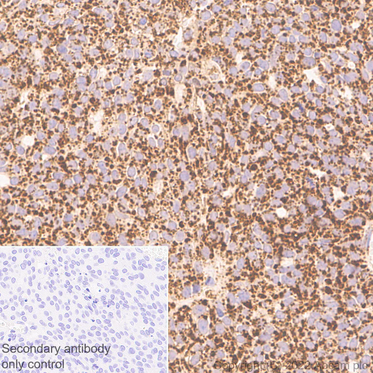 Immunohistochemistry (Formalin/PFA-fixed paraffin-embedded sections) - Anti-MAVS antibody [EPR26357-91] (AB290729)