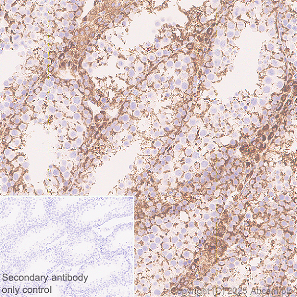 Immunohistochemistry (Formalin/PFA-fixed paraffin-embedded sections) - Anti-MAVS antibody [EPR28262-28] (AB314444), expandable thumbnail