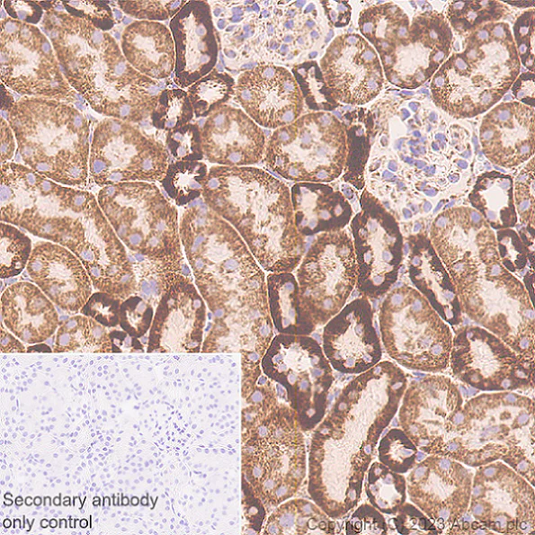 Immunohistochemistry (Formalin/PFA-fixed paraffin-embedded sections) - Anti-MAVS antibody [EPR28262-28] (AB314444)