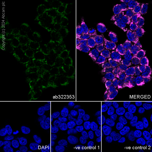 Immunocytochemistry/ Immunofluorescence - Anti-MAVS antibody [RM2067] (AB322353), expandable thumbnail