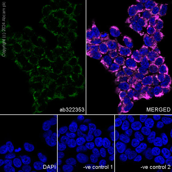 Immunocytochemistry/ Immunofluorescence - Anti-MAVS antibody [RM2067] (AB322353)