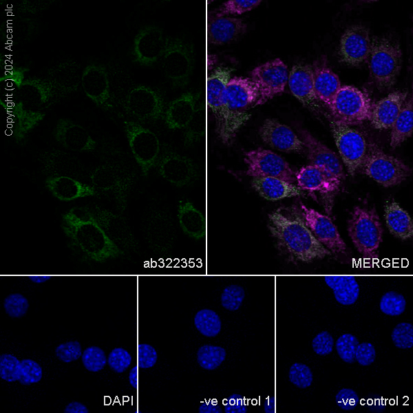 Immunocytochemistry/ Immunofluorescence - Anti-MAVS antibody [RM2067] (AB322353), expandable thumbnail