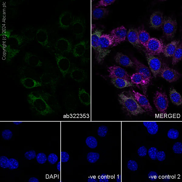 Immunocytochemistry/ Immunofluorescence - Anti-MAVS antibody [RM2067] (AB322353)