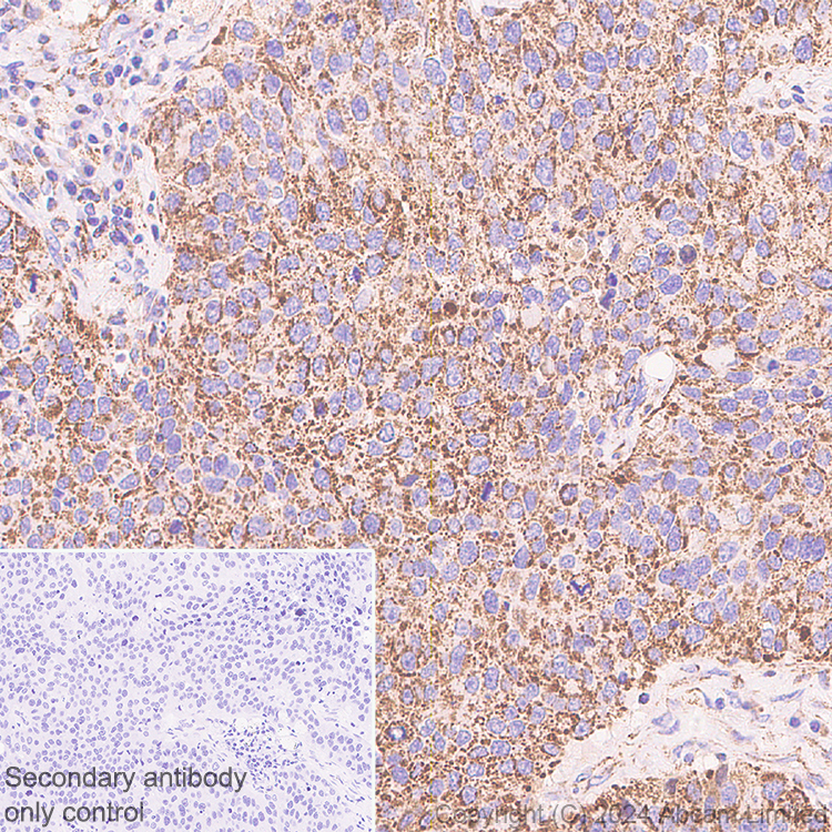 Immunohistochemistry (Formalin/PFA-fixed paraffin-embedded sections) - Anti-MAVS antibody [RM2067] (ab322353), expandable thumbnail