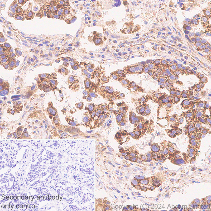 Immunohistochemistry (Formalin/PFA-fixed paraffin-embedded sections) - Anti-MAVS antibody [RM2067] (ab322353), expandable thumbnail