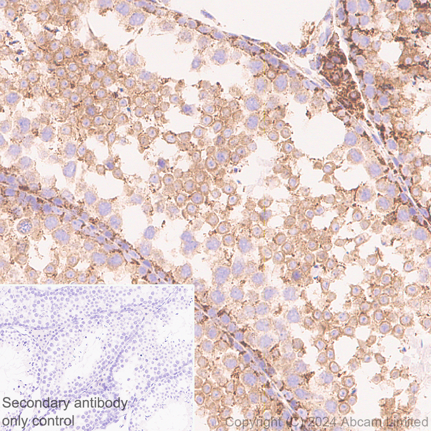 Immunohistochemistry (Formalin/PFA-fixed paraffin-embedded sections) - Anti-MAVS antibody [RM2067] (ab322353), expandable thumbnail