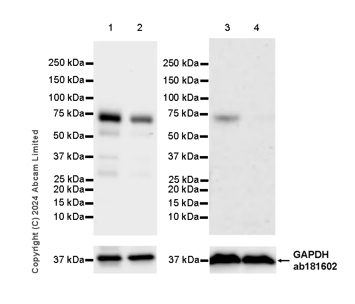 Western blot - Anti-MAVS antibody [RM2067] (AB322353)