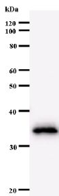 Western blot - Anti-MAX antibody [73C5a] (AB53570), expandable thumbnail