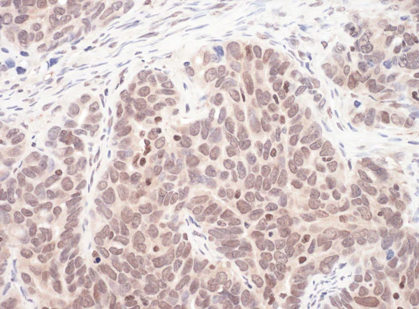 Immunohistochemistry (Formalin/PFA-fixed paraffin-embedded sections) - Anti-MAX antibody (AB101271)