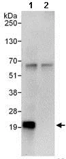 Immunoprecipitation - Anti-MAX antibody (AB101271)