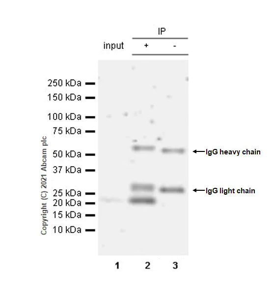 Immunoprecipitation - Anti-MAX antibody [EPR19352] - ChIP Grade (AB199489)