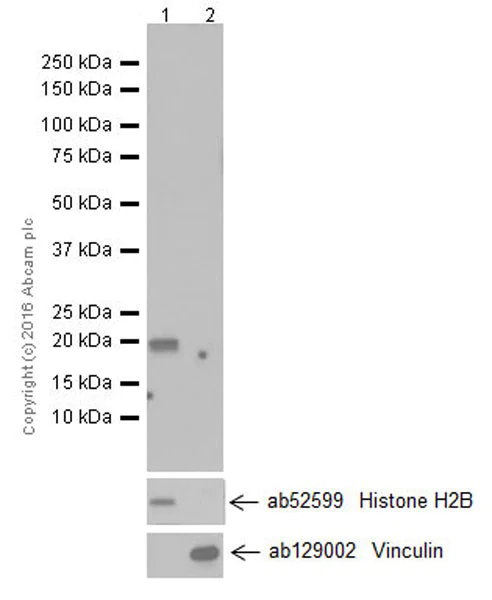Western blot - Anti-MAX antibody [EPR19352] - ChIP Grade (AB199489)