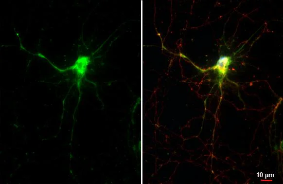 Immunocytochemistry/ Immunofluorescence - Anti-Maxi Potassium channel alpha antibody [HL3164] - BSA and Azide free (AB327516)
