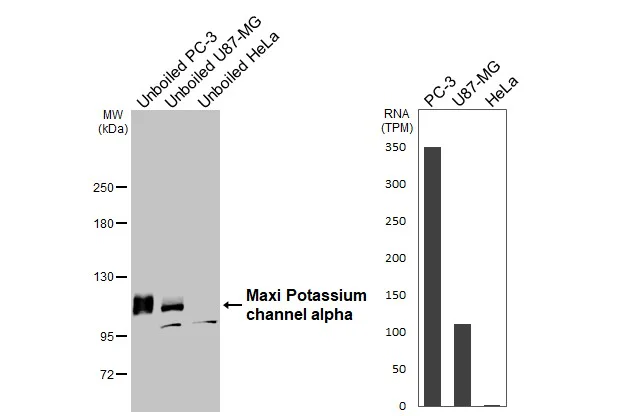 Western blot - Anti-Maxi Potassium channel alpha antibody [HL3164] - BSA and Azide free (AB327516)
