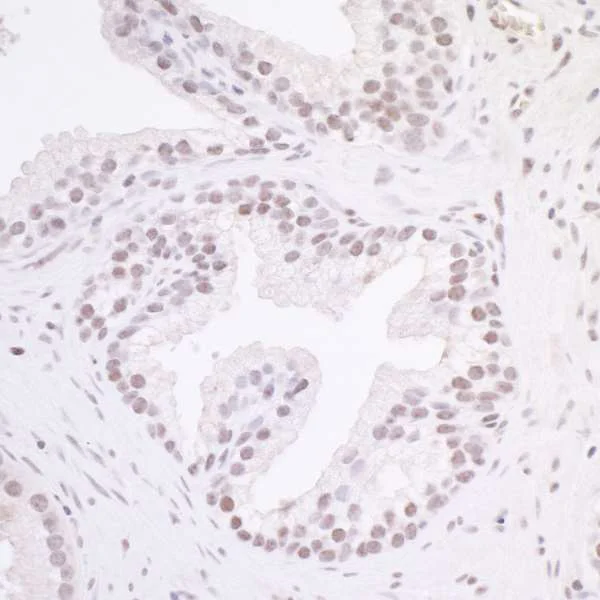 Immunohistochemistry (Formalin/PFA-fixed paraffin-embedded sections) - Anti-MAZ antibody (AB85725)