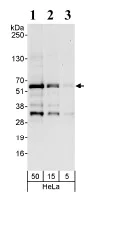 Western blot - Anti-MAZ antibody (AB85725)