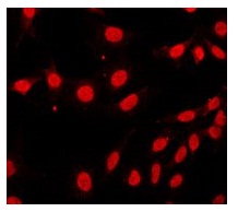Immunocytochemistry/ Immunofluorescence - Anti-MBD1 antibody [EPR3564] (AB108510), expandable thumbnail