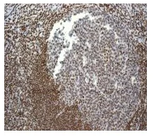 Immunohistochemistry (Formalin/PFA-fixed paraffin-embedded sections) - Anti-MBD1 antibody [EPR3564] (AB108510)