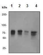 Western blot - Anti-MBD1 antibody [EPR3564] (AB108510), expandable thumbnail